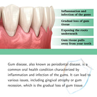 Gum Repair Drops Relieve Receding Gingival Swelling Gum Cleaning Care Oral Periodontal Hygiene Remove Yellow Remove Stain