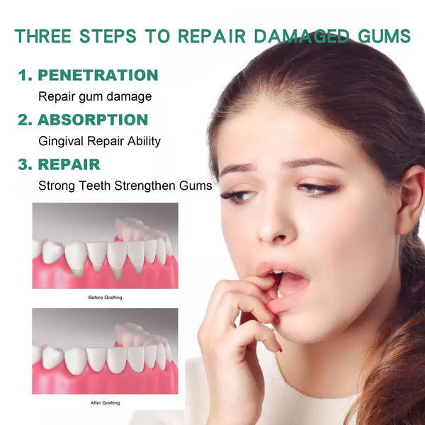 Gum Repair Drops Relieve Receding Gingival Swelling Gum Cleaning Care Oral Periodontal Hygiene Remove Yellow Remove Stain